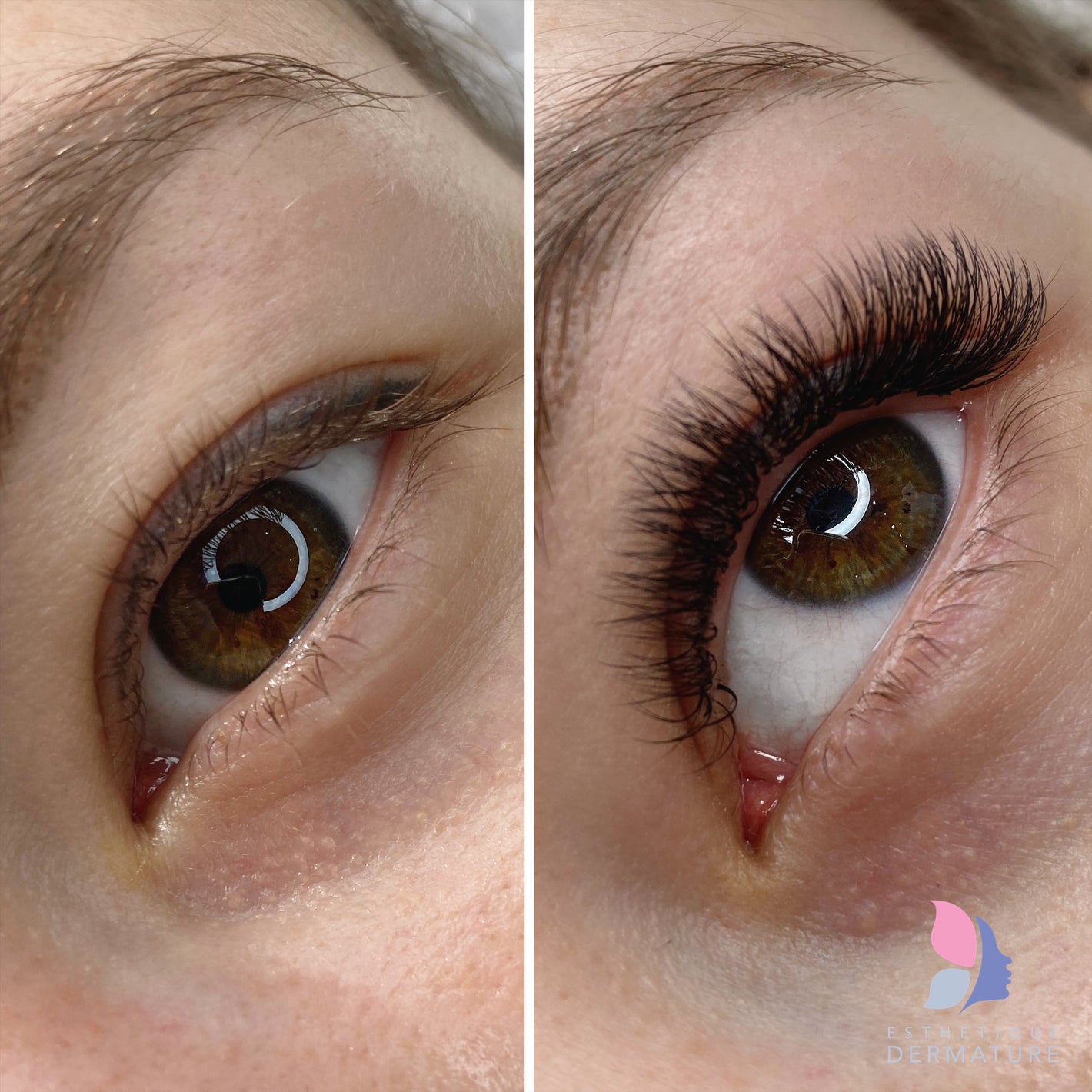 Before & after eyelash extensions Montreal Dermature | Avant et après les extensions de cils - Dermature Montréal