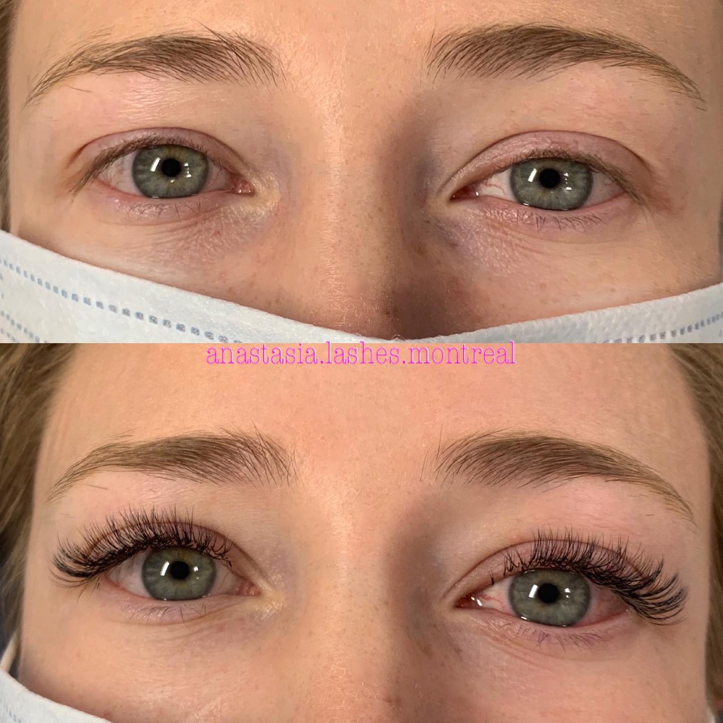Before & after eyelash extensions by dermature